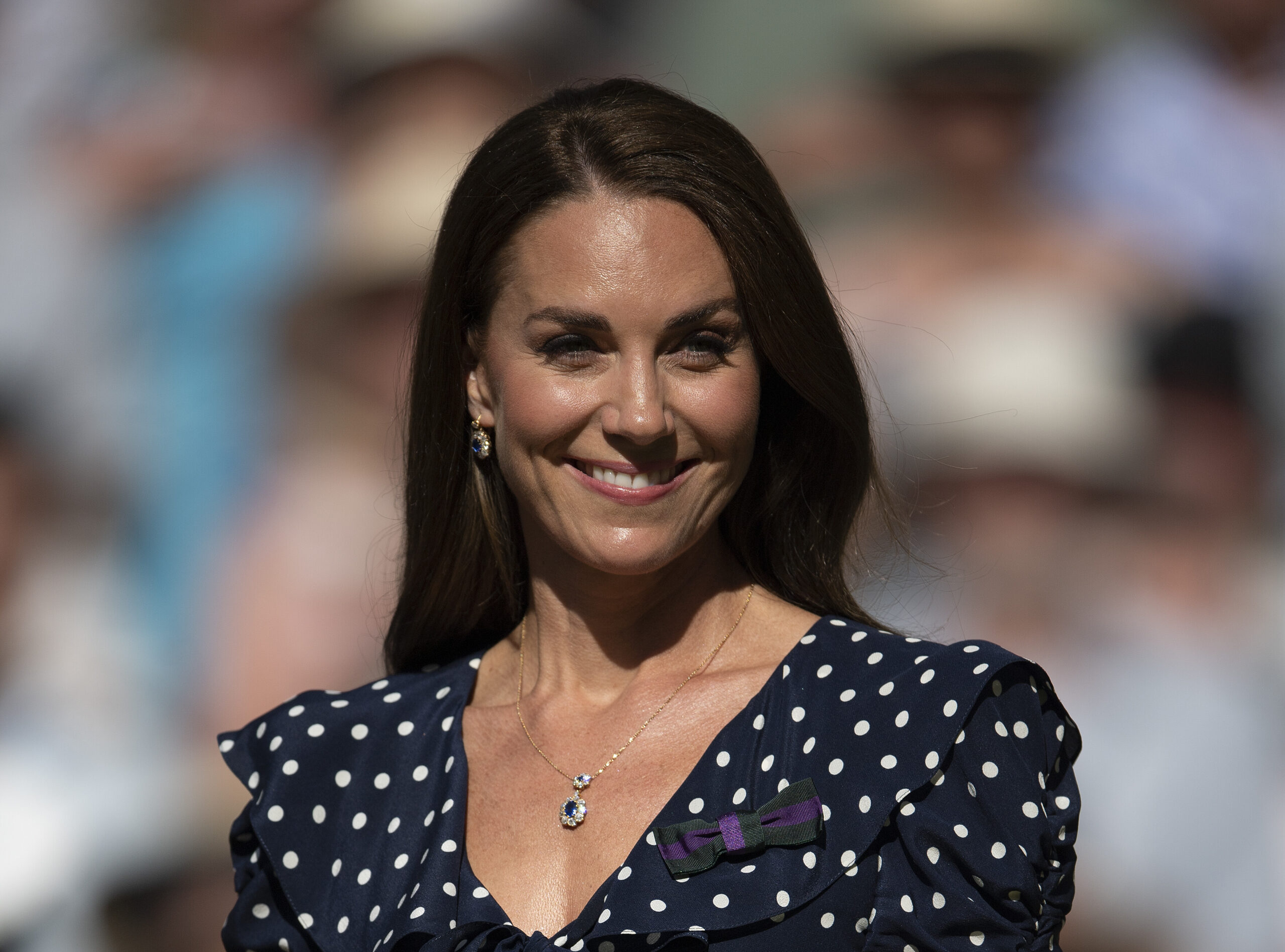 Kate Middleton J Fez Cirurgia Na Cabe A E Faz De Tudo Para Esconder