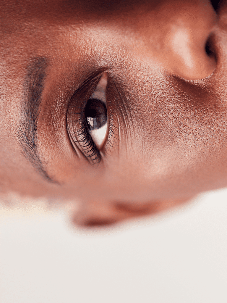 Transforme sua pele: Dicas infalíveis para eliminar olheiras e ter um rosto radiante!