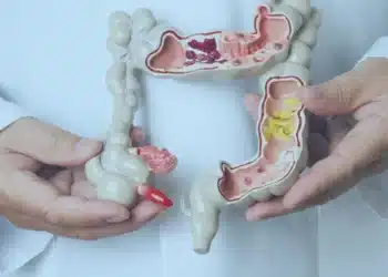 Casos de câncer colorretal cresce entre os jovens; como identificar a doença?